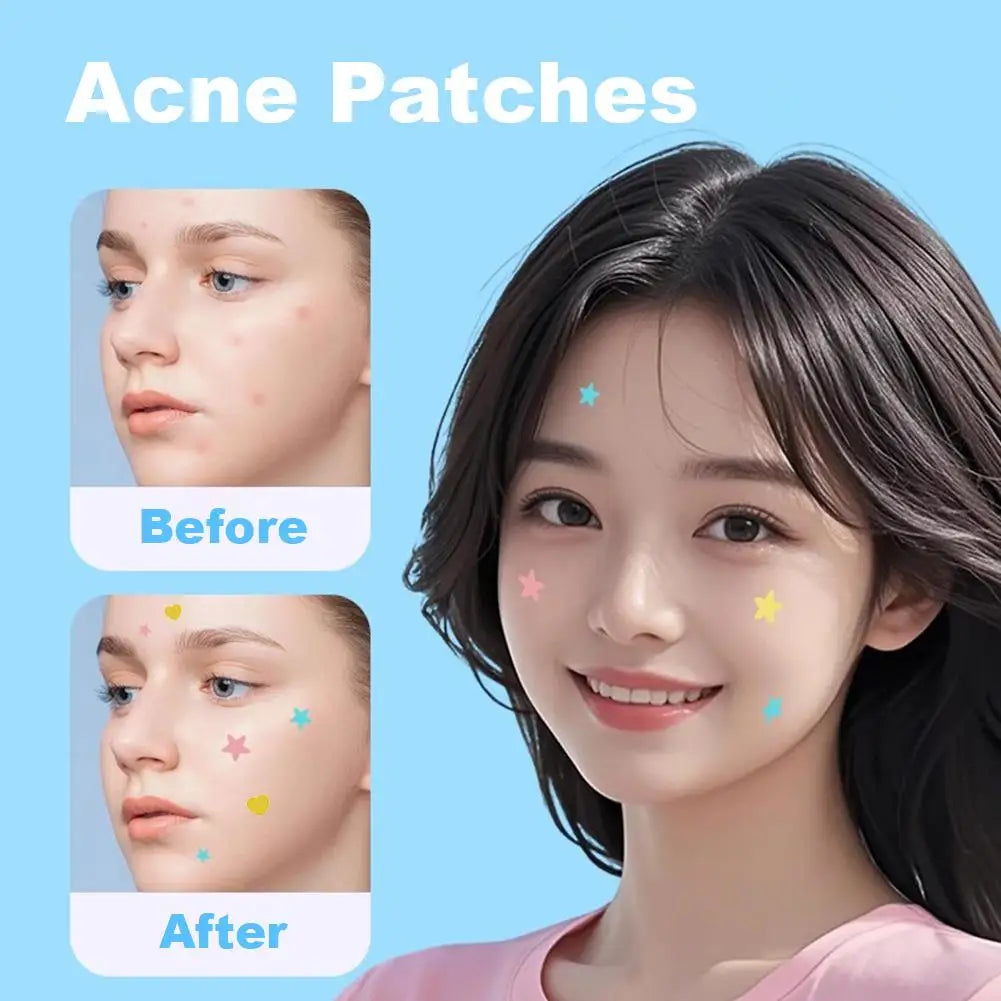 420-1260PC New Colorful Pimple Patch Acne Patches Cute Star Shaped Acne Treatment Stickers Covering Zits Blemishes EVERYDAY ESSENTIALS
