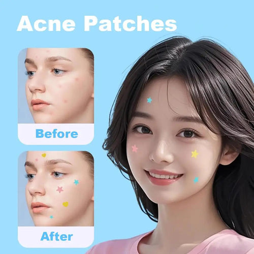 420-1260PC New Colorful Pimple Patch Acne Patches Cute Star Shaped Acne Treatment Stickers Covering Zits Blemishes EVERYDAY ESSENTIALS
