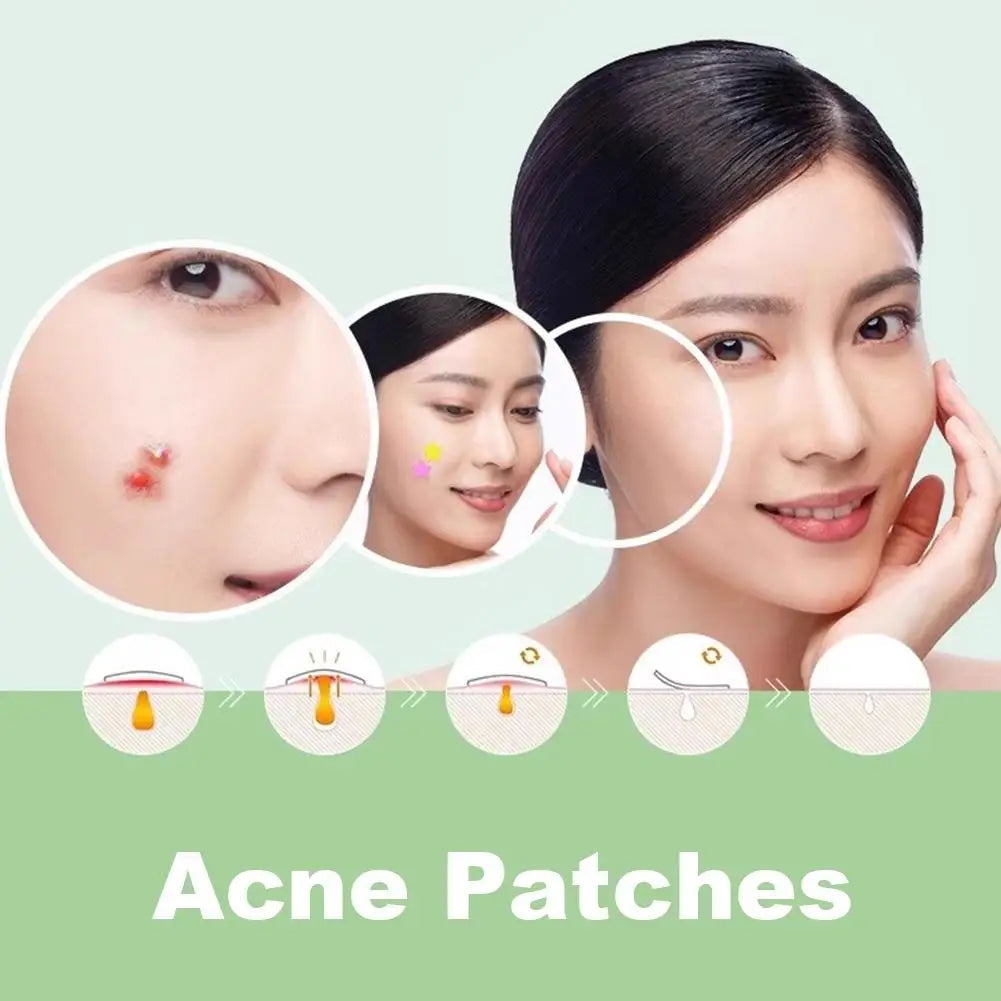 420-1260PC New Colorful Pimple Patch Acne Patches Cute Star Shaped Acne Treatment Stickers Covering Zits Blemishes EVERYDAY ESSENTIALS