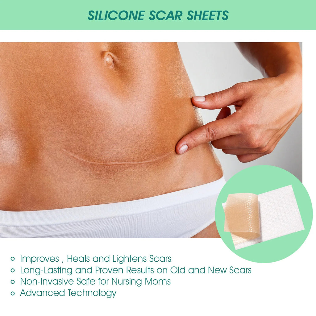 Scar Patches Remove Silicone Gel Sheet Correctors Burn Wounds Efficient Surgery Scar Tape Skin Repair Self-Adhesive Scar Cover EVERYDAY ESSENTIALS