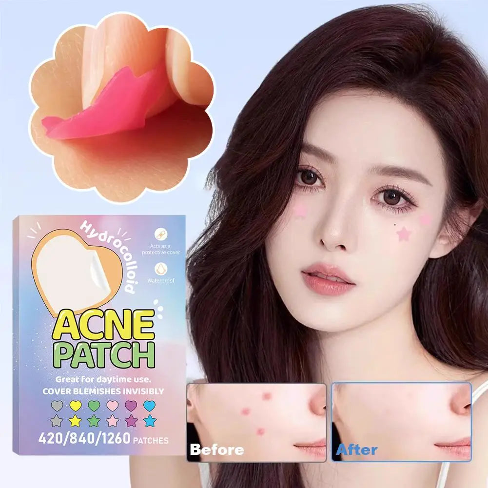 420-1260PC New Colorful Pimple Patch Acne Patches Cute Star Shaped Acne Treatment Stickers Covering Zits Blemishes EVERYDAY ESSENTIALS