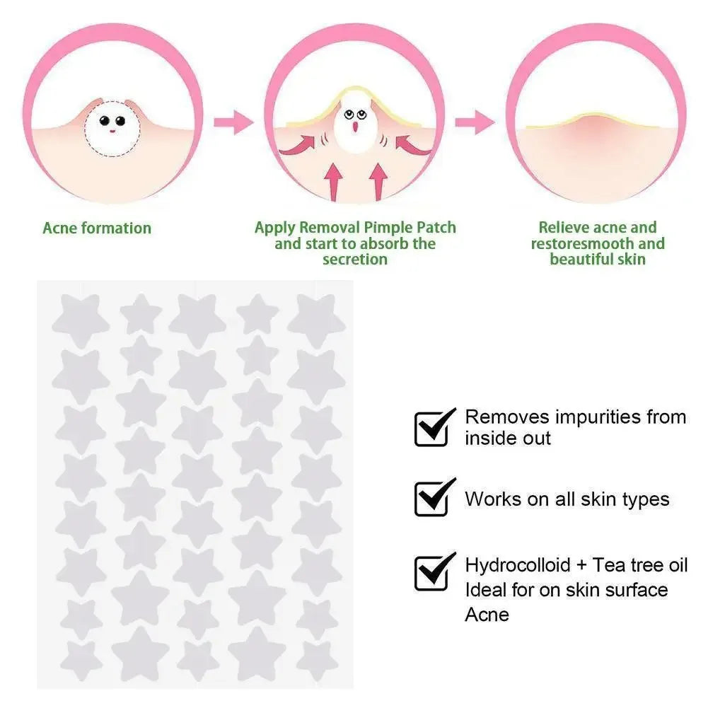 40pcs/120pcs Colorful PE Pimple Patches Cute Star Shaped Pimple Cover Sticker Invisible Pimple Cover Removal Pimple Patch EVERYDAY ESSENTIALS